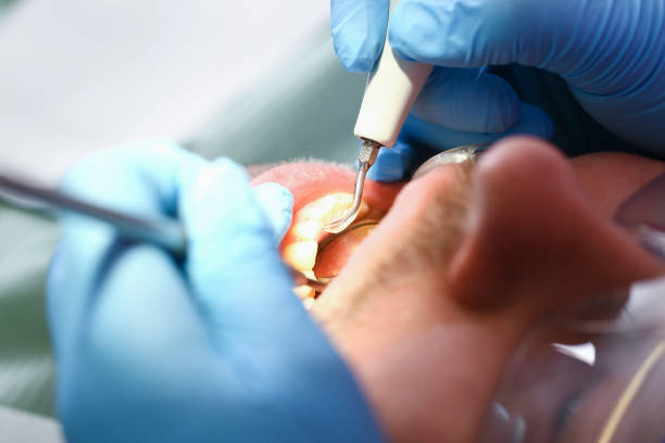 Best Pediatric Emergency Dentist in Kalama, WA