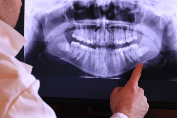 Best Emergency Dental Extractions in Kalama, WA