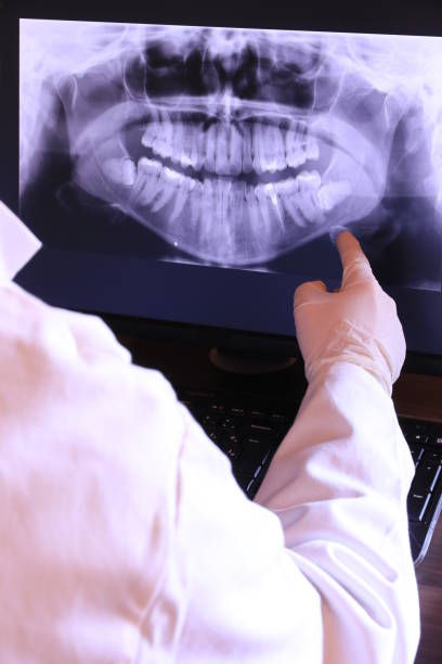 Best Emergency Dentist for Knocked-Out Tooth in Kalama, WA